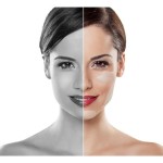 Smart Molds: o que é e qual sua relação com a Harmonização Facial Permanente?