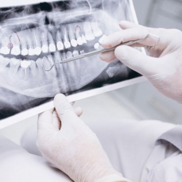 Fraturas Alvéolo-Dentárias em Novo Hamburgo - RS