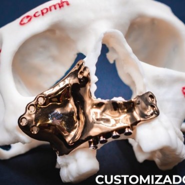 Cirurgias Faciais Complexas em Novo Hamburgo - RS